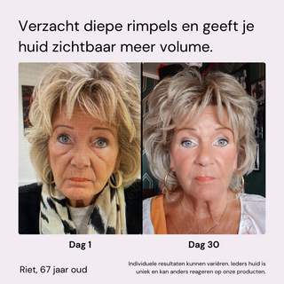 Youth Box | Anti-Aging Kit