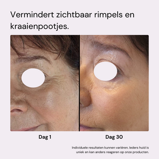 Youth Box | Anti-Aging Kit